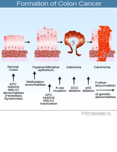 Agydaganatok (a központi idegrendszer daganatai) | szorftabor.hu